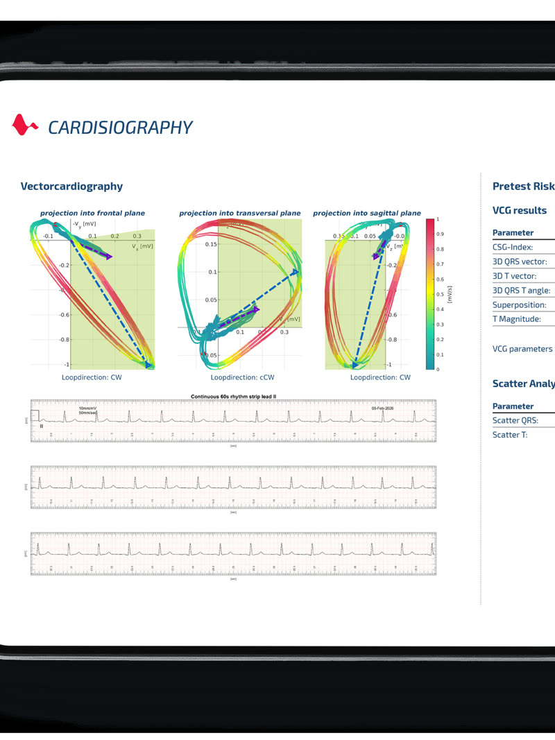 Cardisiographie-Auswertung auf dem Tablet